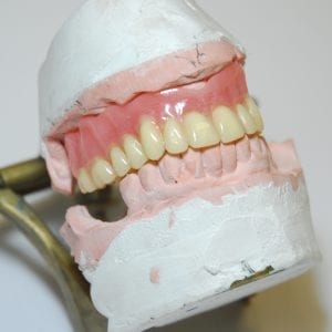 Instant Denture Setups - Finished Denture